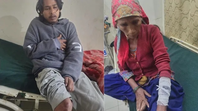 भालू ने हमला कर  एक ही परिवार के चार लोगों को  किया घायल